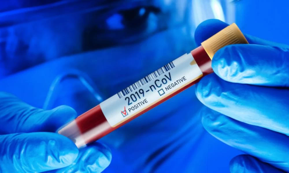 Κορονοϊός - Τα ευεργετικά αποτελέσματα της θεραπείας με πλάσμα πρώην ασθενών